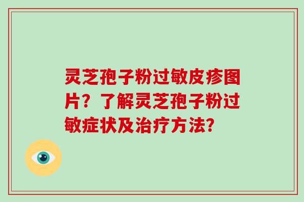 灵芝孢子粉皮疹图片？了解灵芝孢子粉症状及方法？