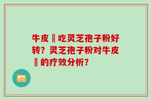 牛皮癬吃灵芝孢子粉好转？灵芝孢子粉对牛皮癬的疗效分析？