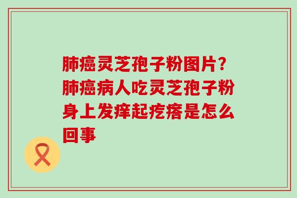 灵芝孢子粉图片？人吃灵芝孢子粉身上发痒起疙瘩是怎么回事