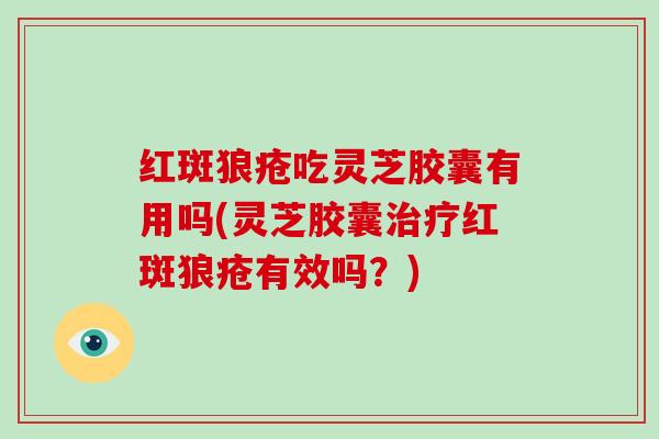 红斑狼疮吃灵芝胶囊有用吗(灵芝胶囊红斑狼疮有效吗？)